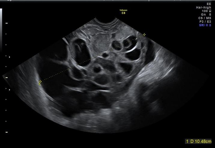 Bilaga 1 bild 11.jpg