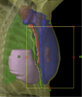 Bild av br&ouml;stkorg