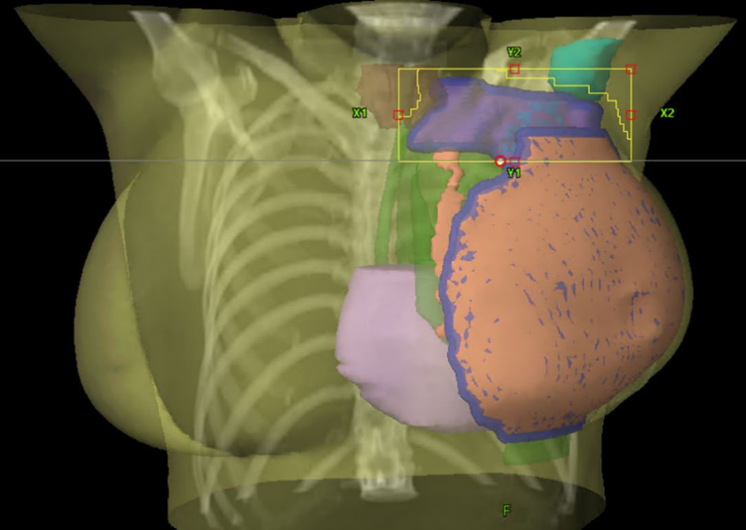 Bild av br&ouml;stkorg