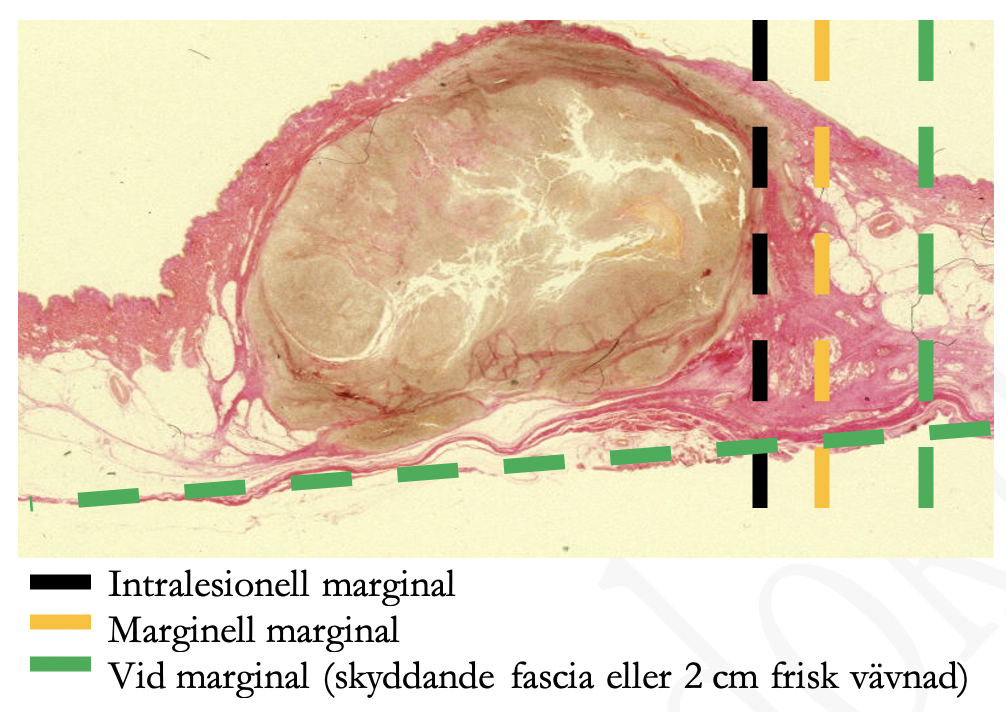 Kap 11.2.1 Figur 2.png