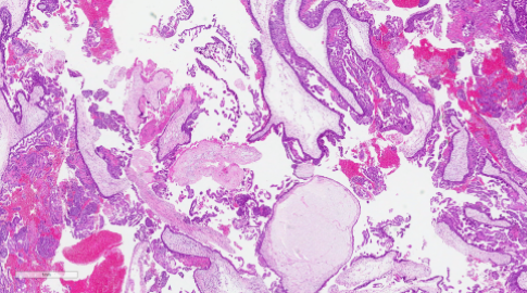 Bilaga 1 Figur 5 A Kvast.png