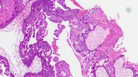 Bilaga 1 Figur 5 B Kvast.png