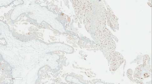 Bilaga 1 Figur 5 C Kvast.png