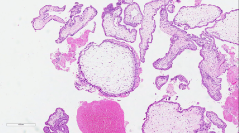 Bilaga 1 Figur 6 A Kvast.png