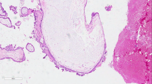 Bilaga 1 Figur 6 B Kvast.png