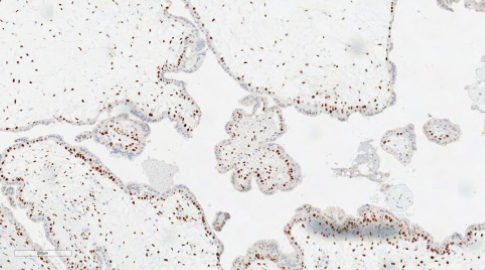 Bilaga 1 Figur 6 C Kvast.png