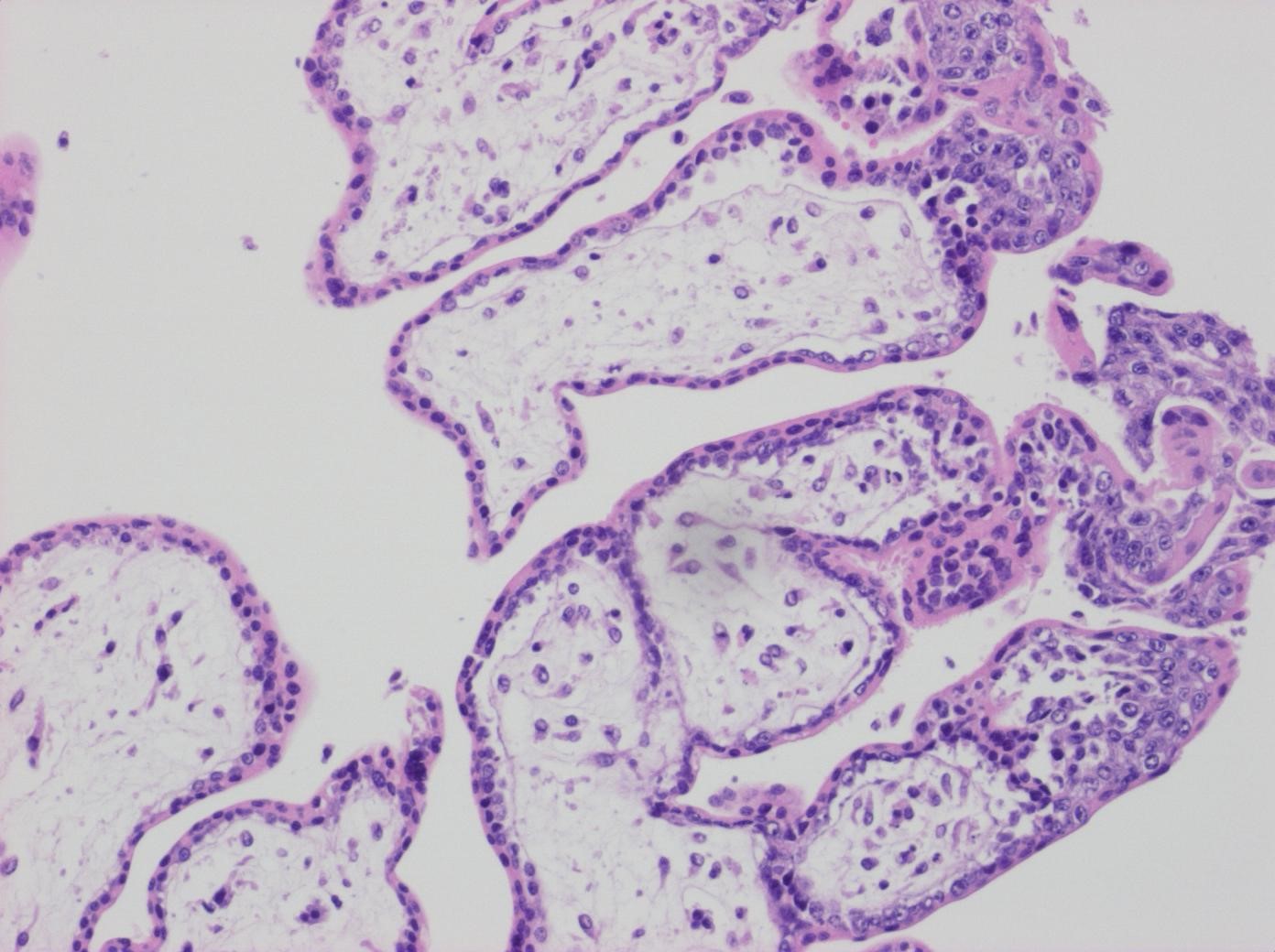 Kap 10.1.2 Figur 4. Normala villi HE.jpg