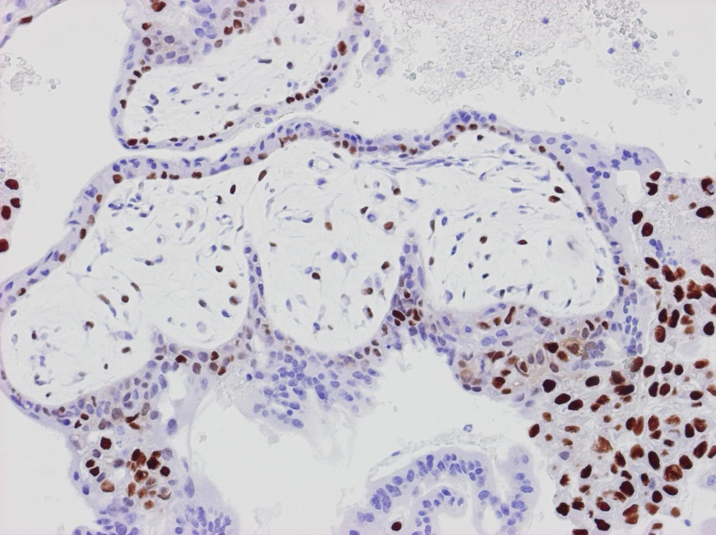 Kap 10.1.2 Figur 5. Normala villi p57KIP.jpg