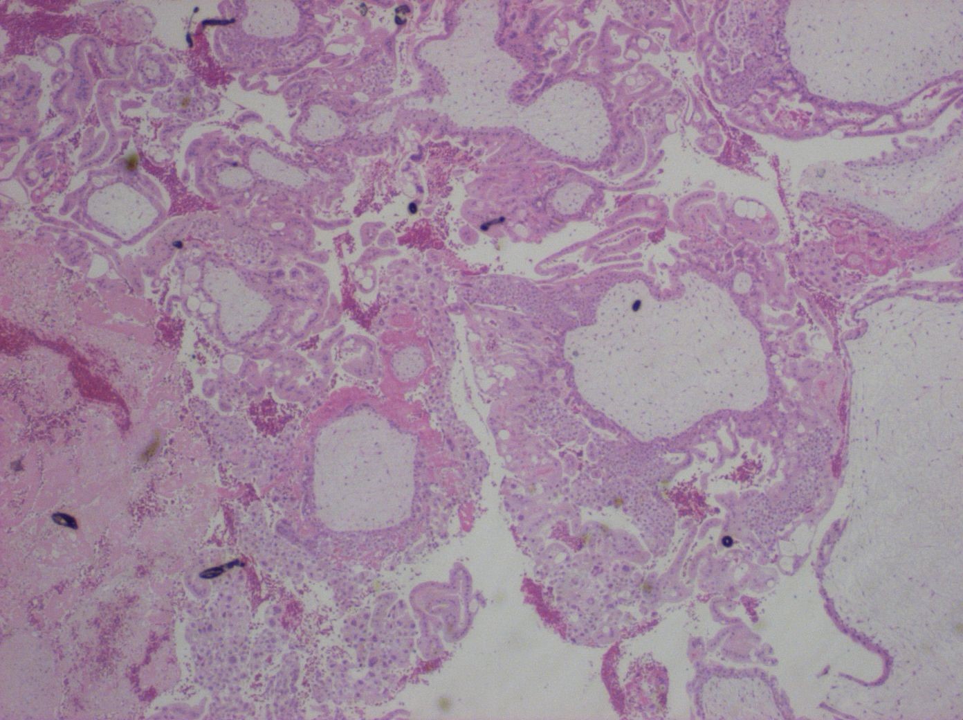 Kap 10.2 Figur 6. Komplett mola HE.jpg