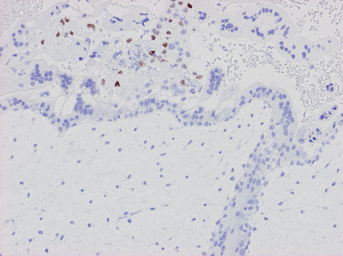 Kap 10.2 Figur 7. Komplett mola p57KIP.jpg