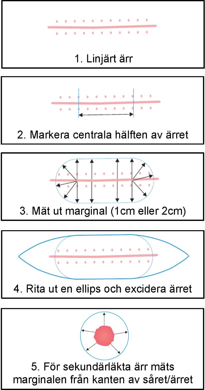 Fem tecknade bilder med instruktion till hur marginalen ska m&auml;tas ut.