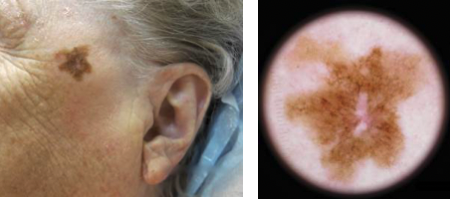 Bilaga 3 Fall 10.png