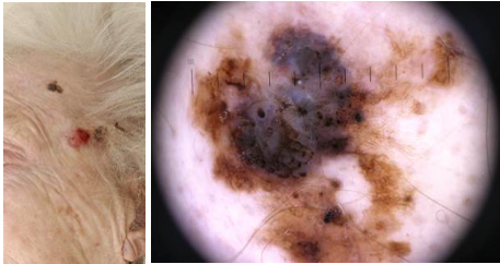 Bilaga 3 Fall 11.png