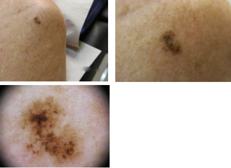 Bilaga 3 Fall 14.png