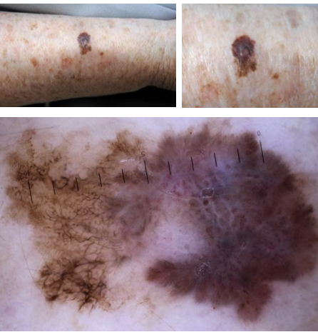 Bilaga 3 Fall 16.png