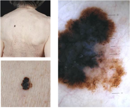 Bilaga 3 Fall 17.png