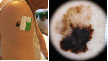 Bilaga 3 Fall 18.png