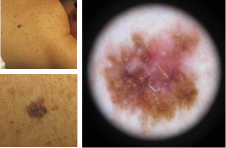 Bilaga 3 Fall 19.png