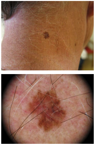 Bilaga 3 Fall 20.png