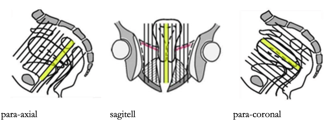 Kap 10.3.1.5 Figur 7.png