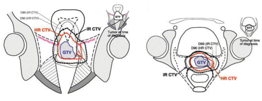 Kap 10.3.1.5.2 Figur 9.png
