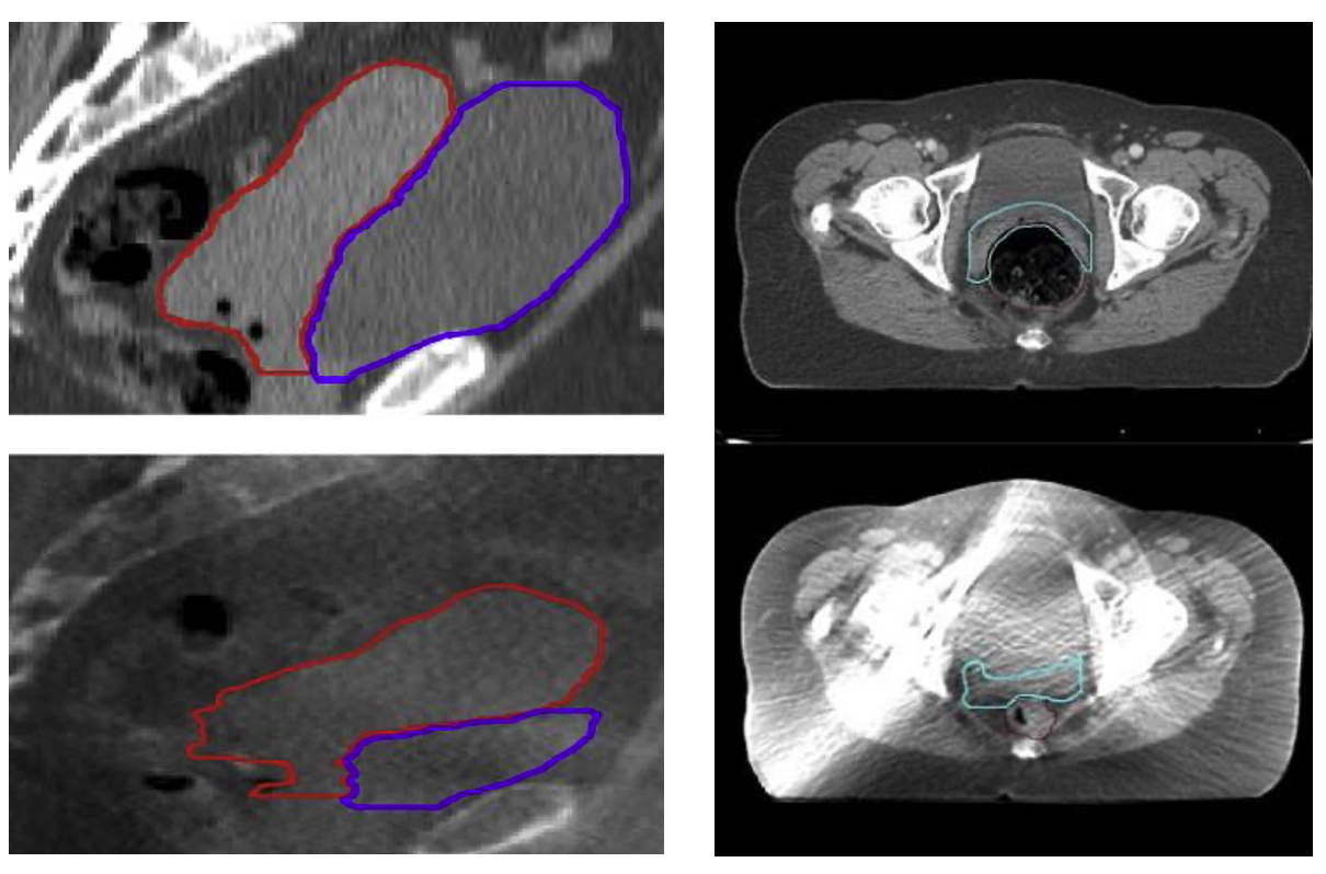 Kap 10.3.1.7.5 Figur 11.png