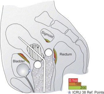 Bilaga 2. Figur 3.png