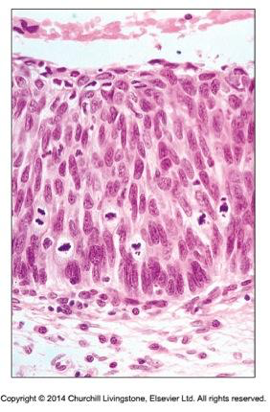 Bilaga 7. 4.1 Figur5.png