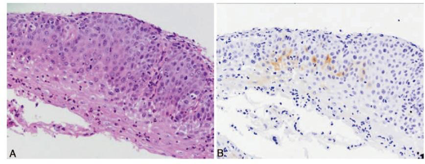 Bilaga 7. 6.2 Figur3.png