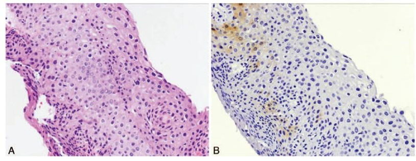 Bilaga 7. 6.2 Figur4.png