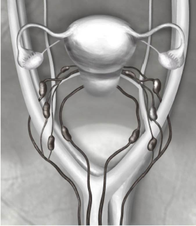 Kap 12_2_3 Fig 5.jpg