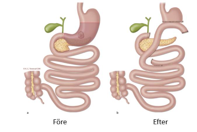 Kap10_3_2_Fig 11.jpg