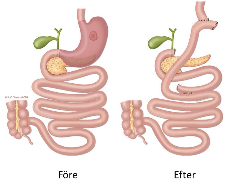 Kap10_3_2_Fig 12.jpg