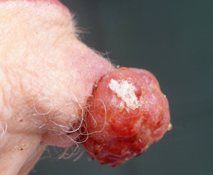 21Primär MCC, haka.jpg